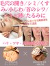 【ダウンタイムほぼ無いエステ版ソフトダーマ】毛穴/シミ/しわ/たるみ肌に◎