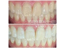 ホワイトニングルーム 川崎店(WhiteningRoom)/ホワイトニング/川崎