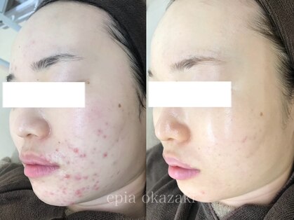 エピア 岡崎店(Epia)の写真