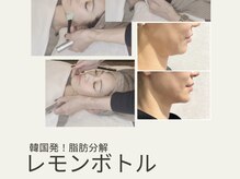 アンフェム(Anfem)/レモンボトル＋ブースターW導入