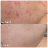 フルオール(FRUOR)