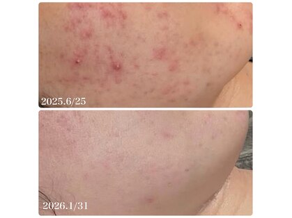 フルオール(FRUOR)の写真