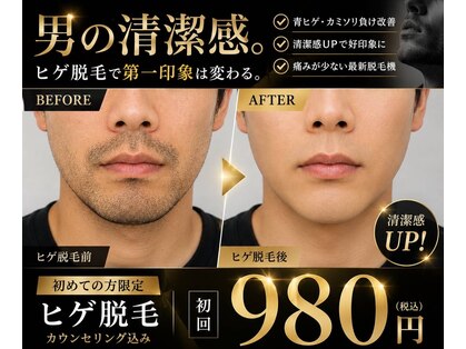 モコ(moco)の写真