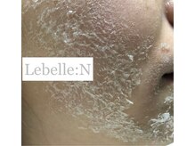 リベル 名古屋(Lebelle:)/ハーブピーリング専門名古屋