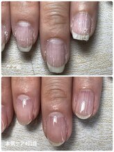 モスト(MOST)/ウィーターケア