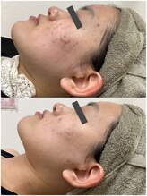 プリマプリート 岐阜店/VOS . WAXセット