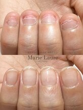 マリーロール 梅田店(Marie Laure)/自爪育成/深爪矯正/ネイルケア