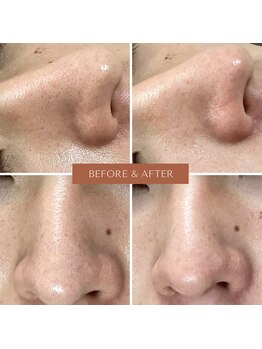 ネリネ(Nerine)/生ビタミンCクレイ