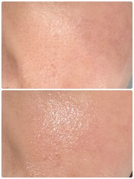 ラン(Ran)/変化写真♪