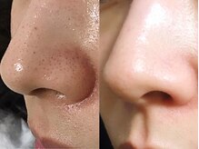 もんたわ鍼灸整骨院の雰囲気（一回で毛穴汚れごっそり！メンズも大歓迎です◎）