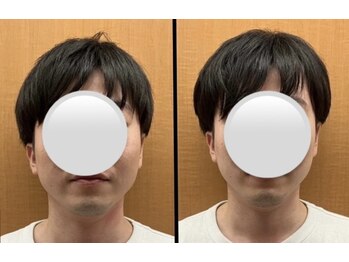 ながっち鍼灸治療院/小顔になりたい！