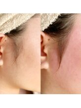 イロドリ(IRODORI)/もみあげWaxで横顔美人に！