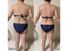 エステ リラクゼーションサロン(more)/背中の丸み・ハミ肉さよなら！