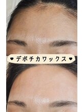 ブラジリアンワックス デボチカ(BrazilianWax DEVOCHIKA)/フェイシャル
