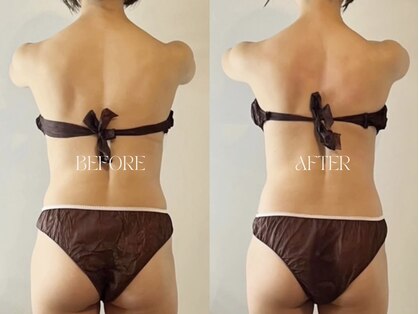 ラティボ 学芸大学(LATIVO)の写真