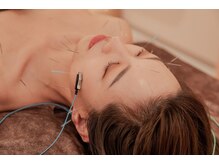 メグリ バイ テトテ(megri by TetoTe)の雰囲気（美容鍼×オイルマッサージ×ホットストーンを融合した施術）