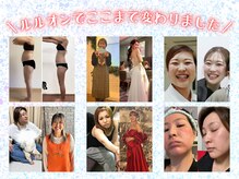 ヨサパーク ラッキー(YOSA PARK Lucky)