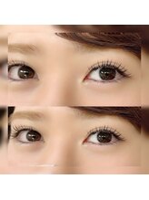 フロラ(Flora)/◇バインドロック