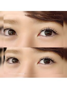 フロラ(Flora)/◇バインドロック