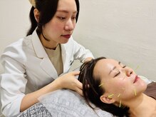 はりきゆうチッタ 自由が丘(はりきゆうCiTTa)/眼精疲労にも効くヘッドスパ