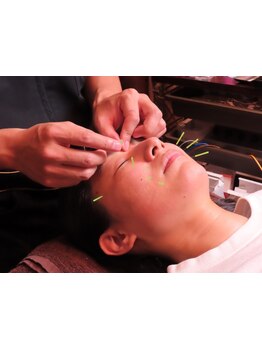 小顔になりたい