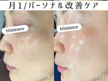 トリニエンス 新宿店(TRINIENCE)/40代/パーソナル改善ケア