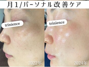 トリニエンス 新宿店(TRINIENCE)/40代/パーソナル改善ケア