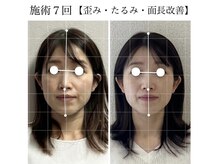 ラボーテヴェリテ(La Beaute Verite)/【お客様施術例】