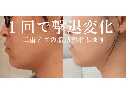 エメ(Aimer)の写真