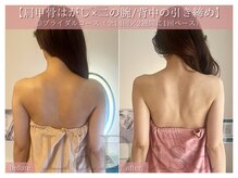 【ブライダル特化コール】肩こり/こり太り改善ドレスリンパ☆