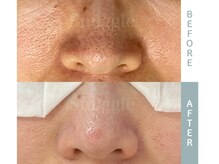 スナグル(Snuggle)