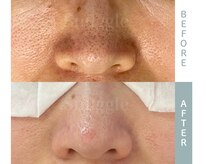 スナグル(Snuggle)