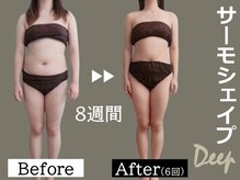 セレブリボーン 大阪ボーテ/サーモシェイプDEEP