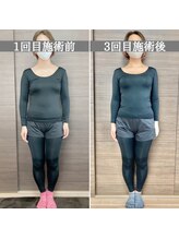 シェア 人形町店(Chare)/【小顔・骨盤矯正・О脚・整体】
