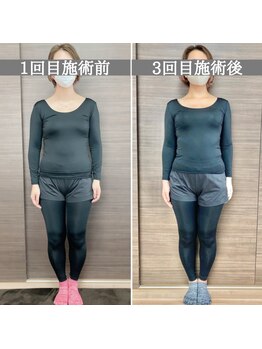 シェア 人形町店(Chare)/【小顔・骨盤矯正・О脚・整体】