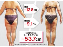 セントラヴィ 上野店/Before After【50代女性】