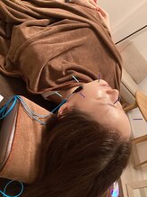 ハリファ鍼灸院 横浜関内院(HariFa鍼灸院)/美容施術