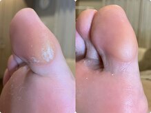 メグムサロン(Megumu Salon)/足つぼ/角質/マッサージ