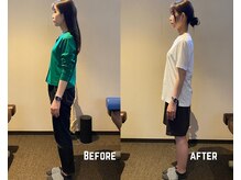 タイコ接骨院 栄本店/【姿勢改善BeforeAfter】
