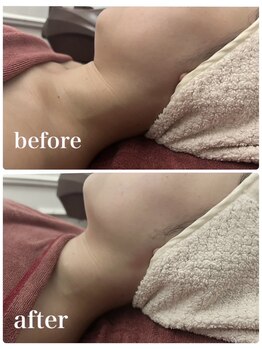 ココセンガビューティークリニック 恵比寿(COCO SENGA Beauty-Clinic)/【Before/After】