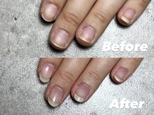 結(Yui)/自爪育成 Before→After