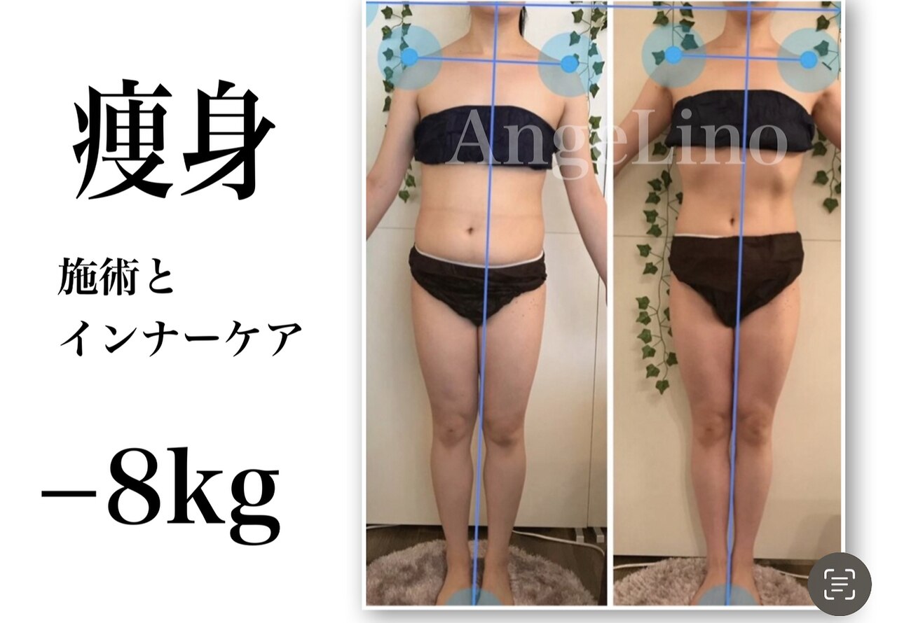 アンジェリーノ(AngeLino)｜ホットペッパービューティー