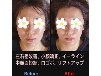 美容矯正サロン レレポノ(LELEPONO)/