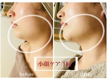 ムク(MUKU 無垢)/フェイスラインがスッキリ