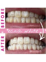 セルフホワイトニングサロン　エクシアホワイトニング熊谷店【4/1 OPEN（予定）】/