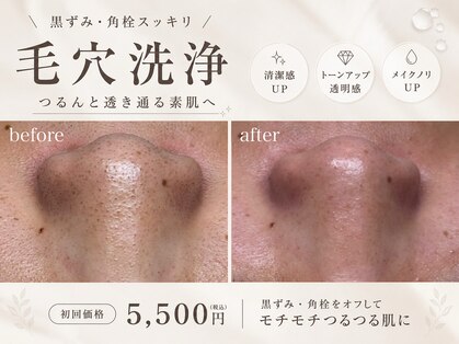 ベルスキン(Bell skin)の写真