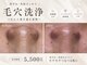 ベルスキン(Bell skin)の写真
