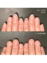 ブラン(blanc)/乾燥・縦筋・形が気になる方へ
