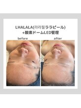 ポムハヌル(pom.haneul)/韓国肌管理室