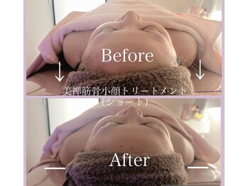 ルナグレイス(LUNA GRACE)/美禅フェイシャル施術前後比較